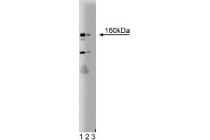 Western blot analysis of DAP Kinase on a SKN (human neuroblastoma) lysate. (DAP Kinase 1 anticorps  (AA 694-947))