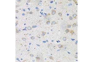 Immunohistochemistry of paraffin-embedded rat brain using GNE antibody. (GNE anticorps  (AA 1-150))