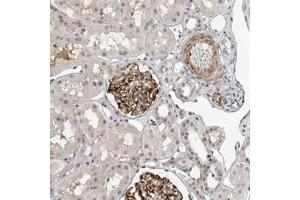 Immunohistochemical staining of human kidney with TRIM66 polyclonal antibody  shows strong cytoplasmic positivity in glomerular cells. (TRIM66 anticorps)