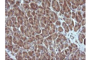 Image no. 1 for anti-Mitogen-Activated Protein Kinase Kinase 3 (MAP2K3) antibody (ABIN1499400)