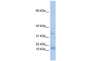 SF3B14 antibody used at 1 ug/ml to detect target protein. (Pre-mRNA Branch Site Protein p14 (SF3B14) (N-Term) anticorps)