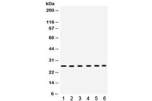 Western blot testing of 1) rat heart, 2) rat liver, 3) mouse liver, 4) human placenta, 5) COLO320 and 6) HeLa lysate with EIF3A antibody. (EIF6 anticorps  (AA 66-210))
