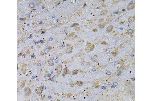 Immunohistochemistry of paraffin-embedded Rat brain using GAD2 Polyclonal Antibody at dilution of 1:100 (40x lens). (GAD65 anticorps)
