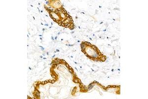 Immunohistochemistry analysis of paraffin embedded mouse skin using CK6 (ABIN7074423) at dilution of 1: 1000 (Keratin 6 anticorps)
