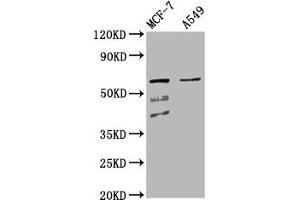 Western Blot Positive WB detected in: MCF-7 whole cell lysate, A549 whole cell lysate All lanes: SLC22A5 antibody at 4. (SLC22A5 anticorps  (AA 42-142))