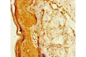 Immunohistochemistry of paraffin-embedded human skin tissue using ABIN7172741 at dilution of 1:100 (TADA2B anticorps  (AA 29-328))