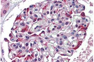 Human Kidney: Formalin-Fixed, Paraffin-Embedded (FFPE)