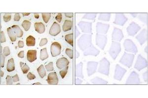 Immunohistochemistry analysis of paraffin-embedded human skeletal muscle tissue, using ATG4B Antibody.