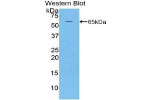 Detection of Recombinant MAP2, Rat using Polyclonal Antibody to Microtubule Associated Protein 2 (MAP2)
