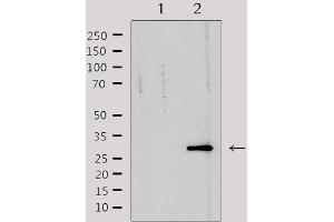 Western blot analysis of extracts from mouse heart, using TNFRSF6B Antibody. (TNFRSF6B anticorps)
