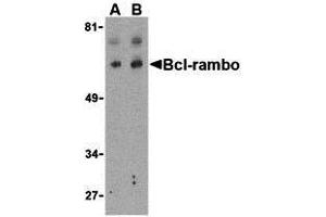 Western Blotting (WB) image for anti-BCL2-Like 13 (Apoptosis Facilitator) (BCL2L13) (Middle Region) antibody (ABIN1030885) (BCL2L13 anticorps  (Middle Region))