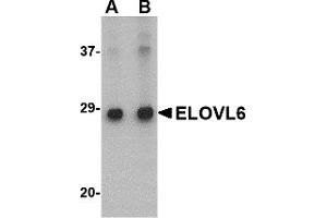 Western Blotting (WB) image for anti-ELOVL Fatty Acid Elongase 6 (ELOVL6) (N-Term) antibody (ABIN1031365) (ELOVL6 anticorps  (N-Term))