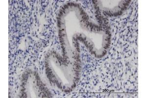 Immunoperoxidase of monoclonal antibody to ZNF24 on formalin-fixed paraffin-embedded human endometrium. (ZNF24 anticorps  (AA 1-368))