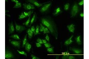 Image no. 2 for anti-serum/glucocorticoid Regulated Kinase 1 (SGK1) (AA 1-432) antibody (ABIN598922) (SGK1 anticorps  (AA 1-432))