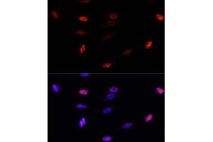 Immunofluorescence analysis of U-2 OS cells using SUMO3 antibody (ABIN7270371) at dilution of 1:100.
