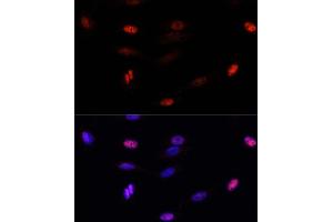 Immunofluorescence analysis of U-2 OS cells using SUMO3 antibody (ABIN7270371) at dilution of 1:100. (SUMO3 anticorps  (AA 1-92))