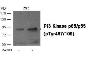 Western blot analysis of extracts from 293 cells untreated or treated with sorbitol using PI3 Kinase p85/p55 (phospho-Tyr467/199)Antibody. (PIK3R1/PIK3R3 anticorps  (pTyr467))