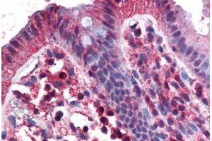 Human Colon (formalin-fixed, paraffin-embedded) stained with TNFRSF17 antibody ABIN351451 at 3 ug/ml followed by biotinylated goat anti-rabbit IgG secondary antibody ABIN481713, alkaline phosphatase-streptavidin and chromogen. (BCMA anticorps  (C-Term))