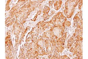 IHC-P Image Immunohistochemical analysis of paraffin-embedded SCC4 xenograft, using TXNDC4, antibody at 1:100 dilution. (ERP44 anticorps)