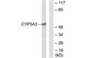 Western Blotting (WB) image for anti-Cytochrome P450, Family 3, Subfamily A, Polypeptide 4/5 (CYP3A4) (AA 251-300) antibody (ABIN2889952) (CYP3A4 anticorps  (AA 251-300))