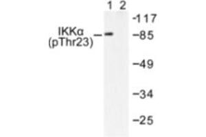 Image no. 1 for anti-conserved Helix-Loop-Helix Ubiquitous Kinase (CHUK) (pThr23) antibody (ABIN318047) (IKK alpha anticorps  (pThr23))