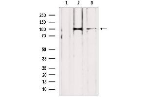 Western blot analysis of extracts from various samples, using LONP1 antibody. (LONP1 anticorps  (C-Term))