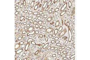IHC analysis of Syntenin 2/SDCBP2 using anti-Syntenin 2/SDCBP2 antibody (ABIN7600017).