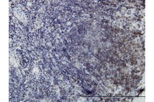 Immunoperoxidase of monoclonal antibody to EPHB3 on formalin-fixed paraffin-embedded human lymph node. (EPH Receptor B3 anticorps  (AA 899-997))