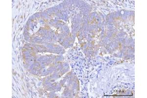 IHC analysis of Hamartin/TSC1 using anti-Hamartin/TSC1 antibody (ABIN7599499). (TSC1 anticorps  (AA 1-618))