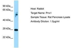 Image no. 1 for anti-Paired Related Homeobox 1 (PRRX1) (C-Term) antibody (ABIN6749858) (PRRX1 anticorps  (C-Term))