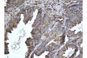 Image no. 2 for anti-Epoxide Hydrolase 1, Microsomal (Xenobiotic) (EPHX1) (AA 21-230) antibody (ABIN1491197)