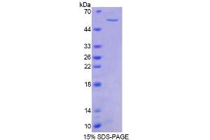 SDS-PAGE analysis of Mouse PTK2b Protein. (PTK2B Protéine)