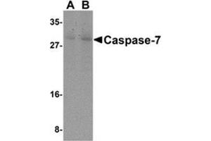 Western blot analysis of Caspase-7 in mouse skeletal muscle cell lysate with Caspase-7 antibody at (A) 0. (Caspase 7 anticorps  (N-Term))