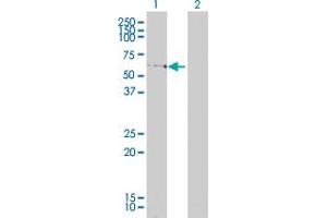 Western Blot analysis of LSM16 expression in transfected 293T cell line by LSM16 monoclonal antibody (M01A), clone 4E3-3A4. (EDC3 anticorps  (AA 1-508))