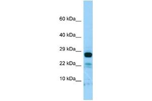 WB Suggested Anti-IL22RA2 Antibody Titration: 1.