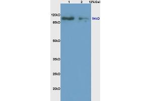 anti-ATG9 Autophagy Related 9 Homolog A (S. Cerevisiae) (ATG9A) (AA 301-400) antibody