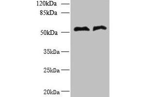 Western blot All lanes: TRIT1 antibody at 3 μg/mL Lane 1: Jurkat whole cell lysate Lane 2: Raji whole cell lysate Secondary Goat polyclonal to rabbit IgG at 1/10000 dilution Predicted band size: 53, 38, 50, 44, 19 kDa Observed band size: 53 kDa (TRIT1 anticorps  (AA 1-324))