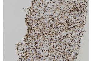 anti-Regulator of Chromosome Condensation 2 (RCC2) (C-Term) antibody