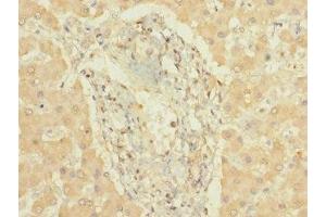 Immunohistochemistry of paraffin-embedded human liver tissue using ABIN7149266 at dilution of 1:100 (CYP3A7 anticorps  (AA 1-200))