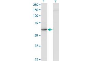 Western Blot analysis of CDR2 expression in transfected 293T cell line by CDR2 monoclonal antibody (M03), clone 4D2. (CDR2 anticorps  (AA 1-454))