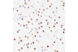 Immunohistochemistry of paraffin-embedded mouse brain using MonoMethyl-Histone H4-R3 antibody (ABIN1680263, ABIN1680264, ABIN6220110 and ABIN6220114) at dilution of 1:100 (40x lens). (Histone H4 anticorps  (meArg3))