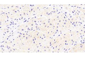 Detection of IkBa in Human Cardiac Muscle Tissue using Polyclonal Antibody to Inhibitory Subunit Of NF Kappa B Alpha (IkBa)
