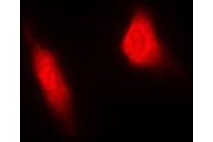 Immunofluorescent analysis of MGCRACGAP staining in HeLa cells. (RACGAP1 anticorps)