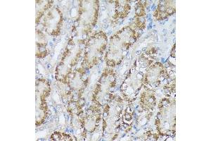 Immunohistochemistry of paraffin-embedded mouse kidney using MTHFD2 antibody (ABIN6132367, ABIN6144144, ABIN6144145 and ABIN6214625) at dilution of 1:100 (40x lens).