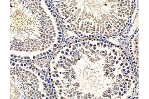 ABIN7096438 and ABIN7100502 at 1/100 staining rat testis tissue by IHC-P. (GRAMD1B anticorps)