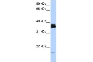 WB Suggested Anti-PPIA Antibody Titration:  0. (PPIA anticorps  (N-Term))