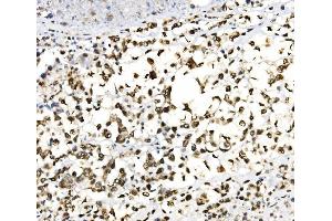 IHC analysis of JUNB using anti-JUNB antibody (ABIN7603223). (JunB anticorps  (N-Term))
