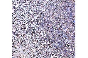 IHC analysis of PPA2 using anti-PPA2 antibody (ABIN6719431). (PPA2 anticorps  (AA 33-334))