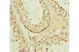 Immunohistochemistry of paraffin-embedded human testis tissue using ABIN7157660 at dilution of 1:100 (KIFC3 anticorps  (AA 140-390))