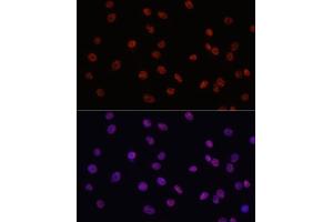 Immunofluorescence analysis of C6 cells using MYCT1 antibody (ABIN7268717) at dilution of 1:100. (Myc Target 1 anticorps  (AA 99-235))
